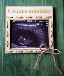 Dřevěný rámeček na fotku z ultrazvuku, Oznámení očekávání miminka | Čekáme miminko, Babičko, dědečku, těším se na vás, Vlastní text